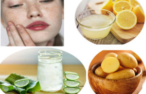 Home Remedies To Treat Hyper-Pigmentation