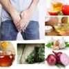 Jock Itch: symptoms, Causes, Treatment and Home Remedies