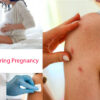 Measles During Pregnancy: How To Take Care Of yourself And Expecting Baby