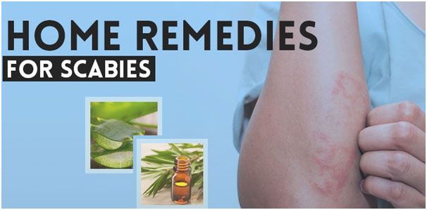 Home Remedies For Scabies