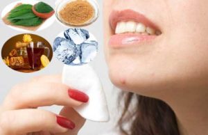 Natural Home Remedies to Get Rid of Chin Acne