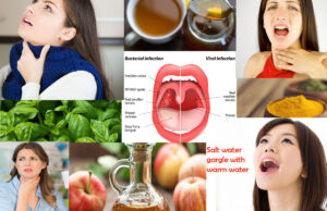 Natural Remedies to Manage Uvulitis