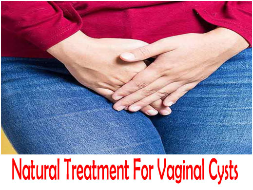 Natural Treatment For Vaginal Cysts