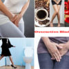 Overactive Bladder: Causes, Symptoms, Diagnosis and Management