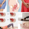 Pelvic Organ Prolapse- Causes, Symptoms and Treatment