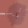 Pinworm Infection: Symptoms, Diagnosis, and Prevention, Treatment