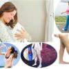 Postpartum Pulmonary Embolism: Risk Factors, Symptoms and Prevention