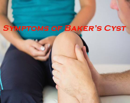 Symptoms of Baker’s Cyst