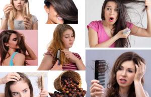 The Best Treatment For Hair Fall In Teenage Girls