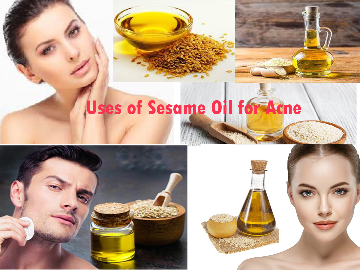 Uses of Sesame Oil for Acne