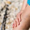Varicose Vein: Causes, Symptoms, and Home Remedies