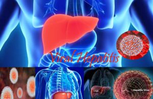 Viral Hepatitis- Types, Symptoms, Diagnosis, and Treatment