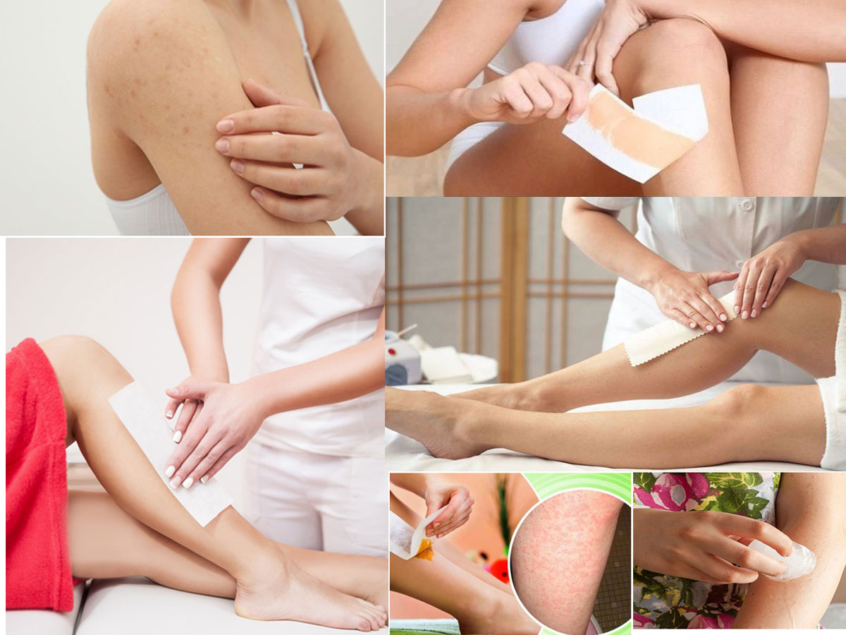 Waxing Bumps: Causes, Remedies and Prevention