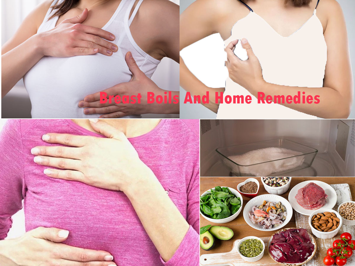 What Are Breast Boils And Home Remedies To Treat Breast Boils