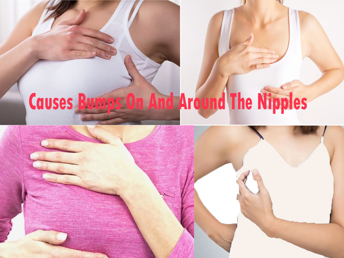 What Causes Bumps On And Around The Nipples