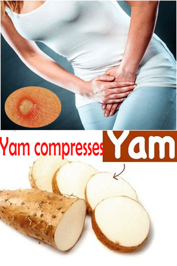 Yam Compresses Remedy For The Private Part Boils